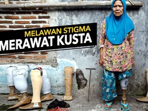 Hari Kusta Sedunia 2018, Mari Hapus Stigma dan Hilangkan Diskriminasi