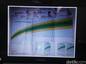2017, Penderita Gizi Buruk di Bondowoso 308 Anak