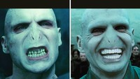 Penampakan Lord Voldemort sebelum ke dokter gigi dan setelah ke dokter gigi. (Foto: Instagram)