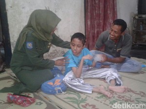 Ridho, Penderita Virus Torch asal Ponorogo Butuh Bantuan