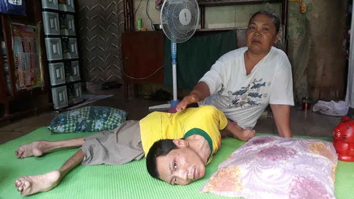 Begini Perjuangan Ibu Rawat Yudo yang 34 Tahun Hanya Terbaring