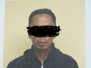 Temukan Luka Bekas Gigitan di Paha Istri, Pria Ini Gelap Mata
