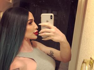 Transgender Ini Operasi Plastik Hingga Rp 1 Miliar Agar Mirip Kylie Jenner
