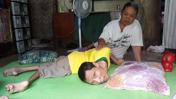 Yudo Utomo dirawat seorang diri oleh ibunya, Kasih. Keduanya juga hidup pas-pasan. (Foto: Sugeng Harianto)