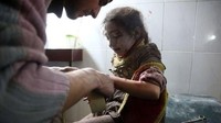 Seorang anak perempuan Suriah menjalani perawatan medis usai menjadi korban gempuran udara rezim Assad di Ghouta Timur. Foto: AFP