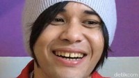 Penegasan Anak Deddy Dores Soal Jual Celana: Memang Butuh Beras