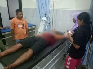 Gara-gara Knalpot Brong, Pemuda Ini Dibacok Tetangga