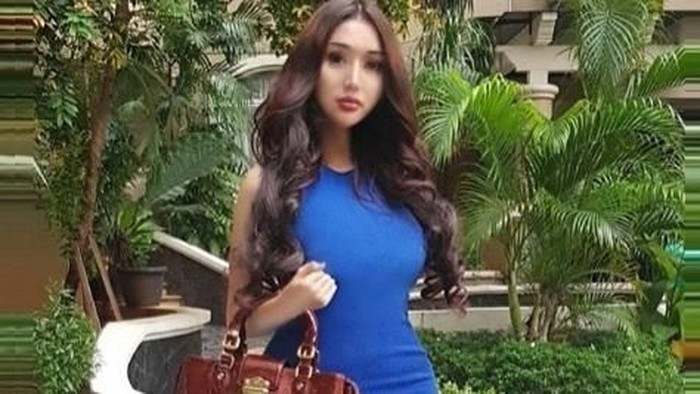 Operasi potong rahang oleh Lucinta Luna makan uang hingga Rp 300 juta. Foto: Dok. Instagram/lucintaluna Operasi potong rahang oleh Lucinta Luna makan uang hingga Rp 300 juta. Foto: Dok. Instagram/lucintaluna