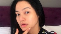 Titi Kamal juga termasuk seleb yang memberi ASI Eksklusif untuk anaknya. Beberapa waktu lalu, Titi sempat memposting satu fotonya tanpa makeup dan berjerawat. “No makeup look ibu menyusui jerawat dan kantong mata kebanyakan bangun di malam hari huhu. Semangattt, semangat jg utk ibu2 lainnya , yg penting anak kita sehat terus, amin ya Rabbal alamin #begadang #nofilter #pejuangasi Foto: Instagram