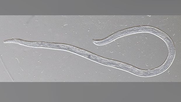 Cacing mata ditemukan di mata wanita Amerika Serikat