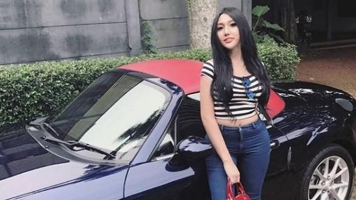 Fakta Implan Bokong Lucinta Luna hingga Tanda Peringatan Bunuh Diri