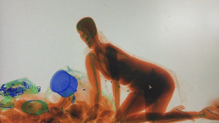 Wanita di China masuk mesin x ray. Foto: Metro Wanita di China masuk mesin x ray. Foto: Metro