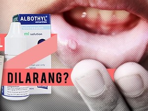 Izin Edar Albothyl Dibekukan, PT Pharos Siap Tarik Produknya