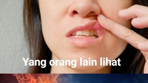 Kumpulan Meme Sariawan, Kocak Sekaligus Nyebelin