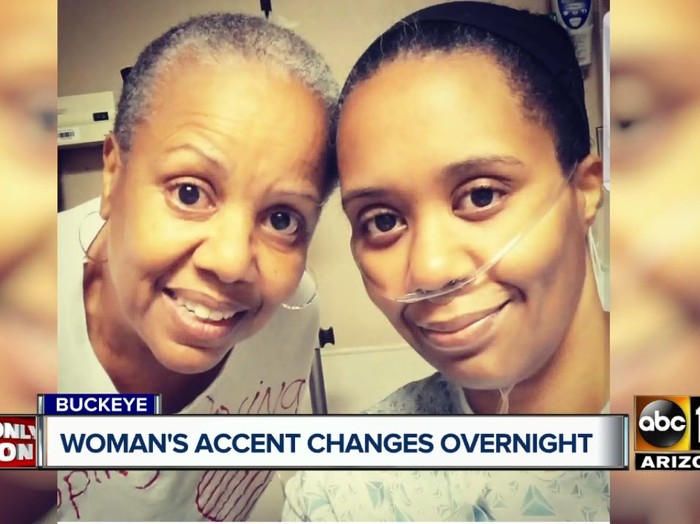 Bangun dari Tidur, Wanita Amerika Ini Tahu-tahu Bisa Beraksen Inggris