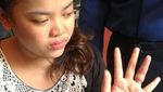 Aksi Petugas Damkar Lepas Cincin Nyangkut Pakai Sabun