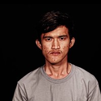Pria bernama Noppajit Monlin ini adalah seorang buruh pabrik di Thailand. Ia sangat tidak percaya diri akan penampilannya dan merasa malu dengan wajahnya yang dipenuhi bekas jerawat. Foto: dok. Let Me In