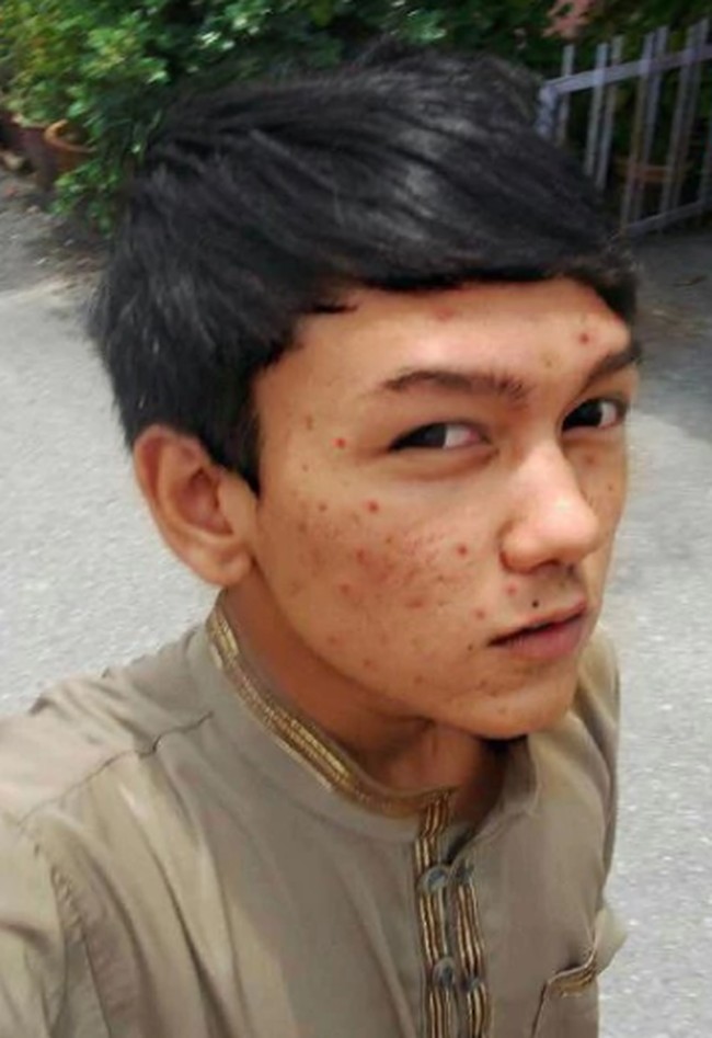 Amirul Rizwan Musa adalah pria asal Malaysia yang melakukan perubahan ekstrem pada fisiknya dengan jalan operasi plastik. Bahkan ia hampir menghabiskan Rp 1 miliar demi penampilan barunya itu. Foto: Facebook