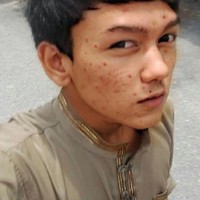 Amirul Rizwan Musa adalah pria asal Malaysia yang melakukan perubahan ekstrem pada fisiknya dengan jalan operasi plastik. Bahkan ia hampir menghabiskan Rp 1 miliar demi penampilan barunya itu. Foto: Facebook