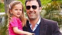 Untuk menghilangkannya kamu bisa menempuh jalur operasi. Kalau Ben Affleck sih tidak butuh karena memang punya kondisi ini sejak lahir. Foto: Istimewa
