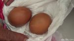 Ini Hasil Rontgen Remaja di Gowa yang Kembali Keluarkan Telur