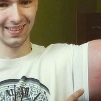 Risiko komplikasinya kasus ini sangat tinggi tapi jika lamban dilakukan tidak akan menolong pasien. Zat beracun jangka panjang dalam tubuh dapat mempersulit kerja ginjal dan menyebabkan kematian, tuturnya.Foto: Instagram