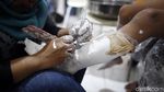 Harapan Baru untuk Si Pengguna Kaki Palsu