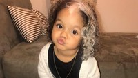Kami tidak yakin dari mana awal tanda lahirnya karena nenek saya diadopsi saat kecil dan belum pernah bertemu keluarga kandungnya, ujar Brianna Worthy, ibu dari MilliAnna seperti dikutip dari Daily Mail. (Foto: Facebook/Brianna Worthy)