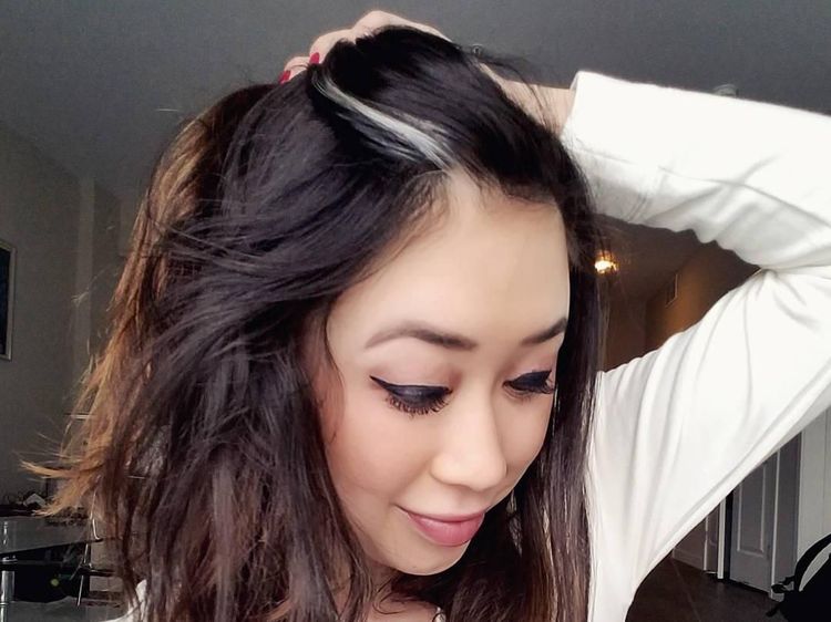 Mirip Anna Frozen, Para Wanita Cantik Ini Punya Poliosis di Rambut