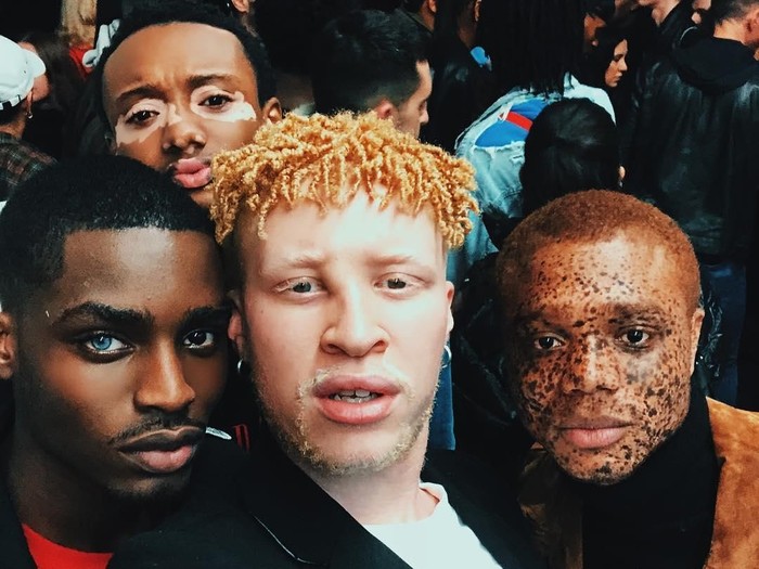 Keempat pria dengan kondisi kulit ini berbeda menunjukkan bahwa mereka bisa menjadi model dengan keunikannya itu. Salah satunya pengidap albinisme. (Foto: Instagram/souffrantnyc) Keempat pria dengan kondisi kulit ini berbeda menunjukkan bahwa mereka bisa menjadi model dengan keunikannya itu. Salah satunya pengidap albinisme. (Foto: Instagram/souffrantnyc)