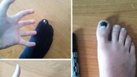 Kaus kaki sudah berlubang? Jangan beli kaos kaki baru. Warnai kuku jempol Anda dengan spidol hitam, beres. Istimewa/Boredpanda.