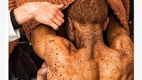 Bintik-bintik hitam di sekujur tubuhnya adalah sebuah kondisi yang mirip dengan vitiligo. Namun sebenarnya kondisi ini tidak berbahaya ataupun menular. (Foto: Instagram/souffrantnyc)