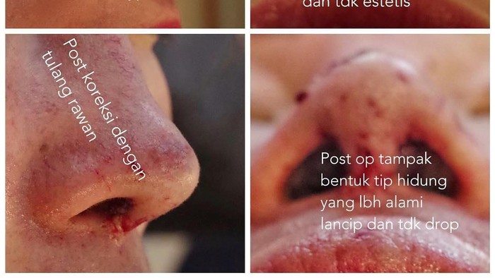 dok. Instagram dok. Instagram