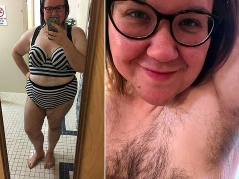 Kisah Wanita yang Di-bully karena Penuh Bulu Dari Dada Hingga Punggung 