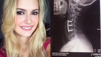 Marcelle Mancuso asal Brazil pada Januari 2016 pernah mengalami kecelakaan saat sit up yang menyebabkannya menjadi lumpuh. Foto: Instagram/marcellemancuso