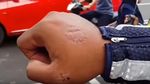 Foto: Aksi Emak-emak Gigit Tangan dan Pukuli Polisi di Kudus