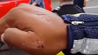 Tak terima ditilang, Anik kemudian menggigit tangan Briptu Erlangga sampai berbekas (Foto: Screenshot Video)