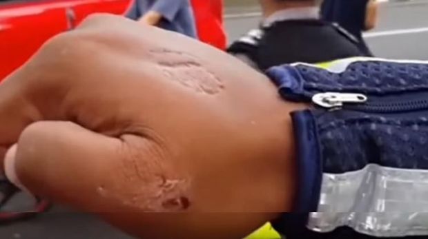 Videonya Viral, Ini Kata Polisi yang Tangannya Digigit Warga Kudus