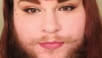 Wanita 26 tahun asal Virginia ini didiagnosis mengidap polycystic ovary syndrome (PCOS) sejak usia 15 tahun. Facebook: Nova the Bearded Babe 