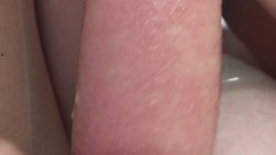 Seorang balita asal Minnesota menjadi viral di media sosial karena alergi air langka yang diidapnya. Ia mengalami ruam dan gatal-gatal begitu ia tersentuh air.
