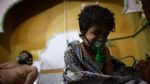 Douma Dibom Rezim Suriah, Sejumlah Warga Sesak Napas