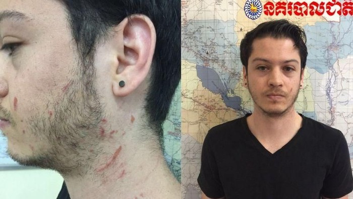 Bunuh Wanita Tukang Pijat, Turis AS Ditangkap di Kamboja