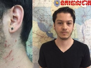 Bunuh Wanita Tukang Pijat, Turis AS Ditangkap di Kamboja