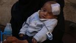 Foto: Bayi Karim Bermata Satu yang Sembunyi karena Serangan Assad