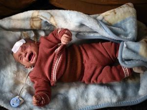 Foto: Bayi Karim Bermata Satu yang Sembunyi karena Serangan Assad