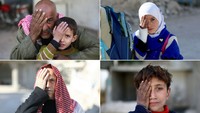 Tahun lalu, foto bayi Karim yang kehilangan sebelah matanya ini memicu kampanye solidaritas di media sosial. Foto: Amer Alshami/Anadolu Agency/Getty Images