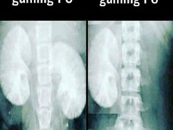 Meme Lucu Perdebatan Main Game di PC dan Konsol