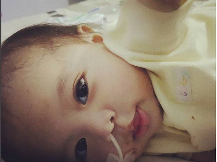 Mengenal Sindrom GGM, Penyakit Langka yang Buat Bayi Tak Bisa Minum ASI