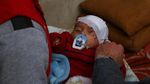 Foto: Bayi Karim Bermata Satu yang Sembunyi karena Serangan Assad