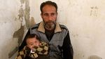 Foto: Bayi Karim Bermata Satu yang Sembunyi karena Serangan Assad